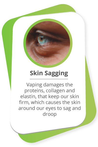 Skin Sagging: Vaping damages the proteins, collagen and elastin, that keep our skin firm, which causes the skin around our eyes to sag and droop.